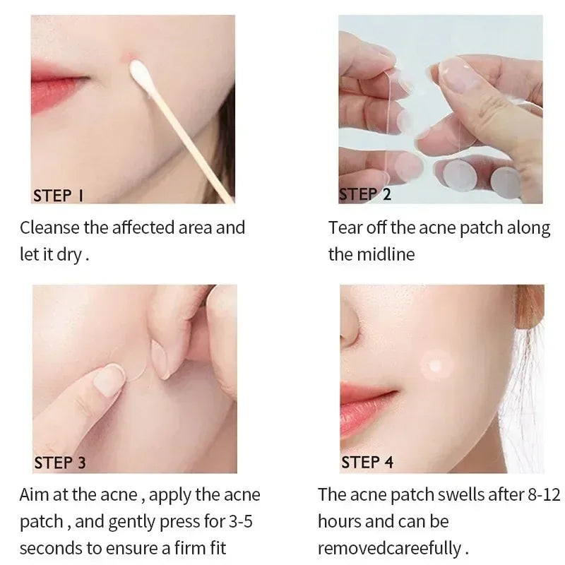 LANBENA Acne Pimple Patch – Blemish Repair Stickers Day & Night