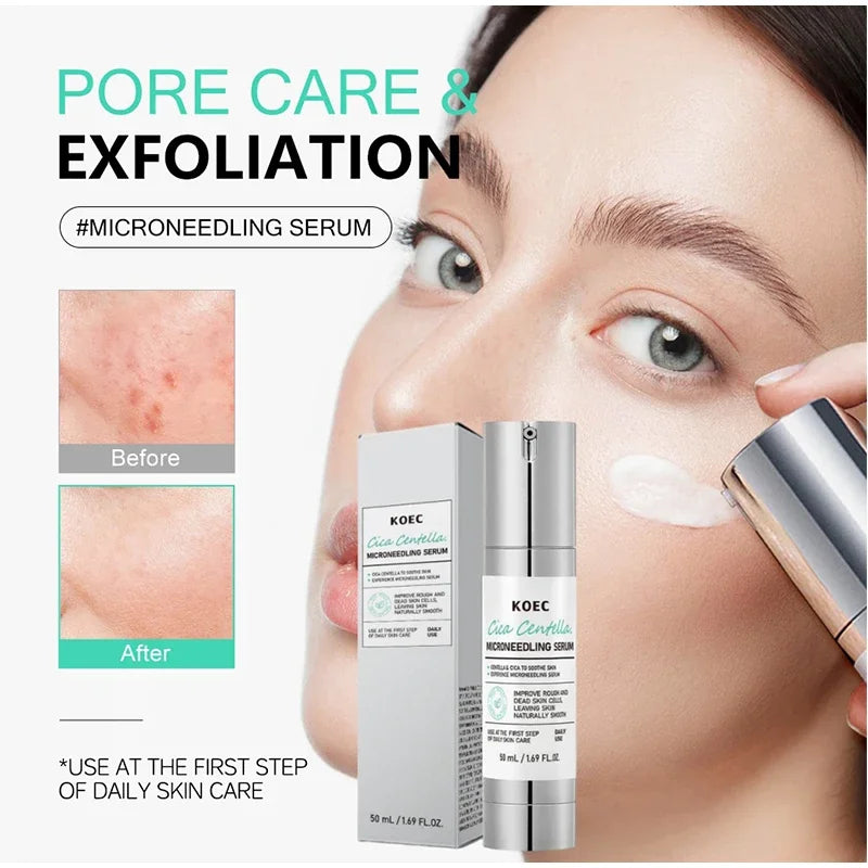 Centella Asiatica Microneedle Face Serum | Hydrating & Brightening