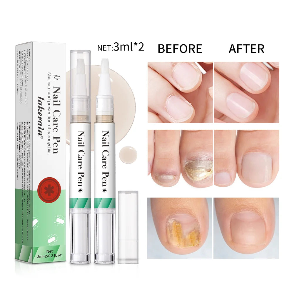 Nail Growth Oil Nail Treatment Cuticle Revitalizer Oil Prevent Agnail Nail Polish Nail Nutrition Oil Pen Manicure Nail Repair Peaceful Pleasures Health and Wellness