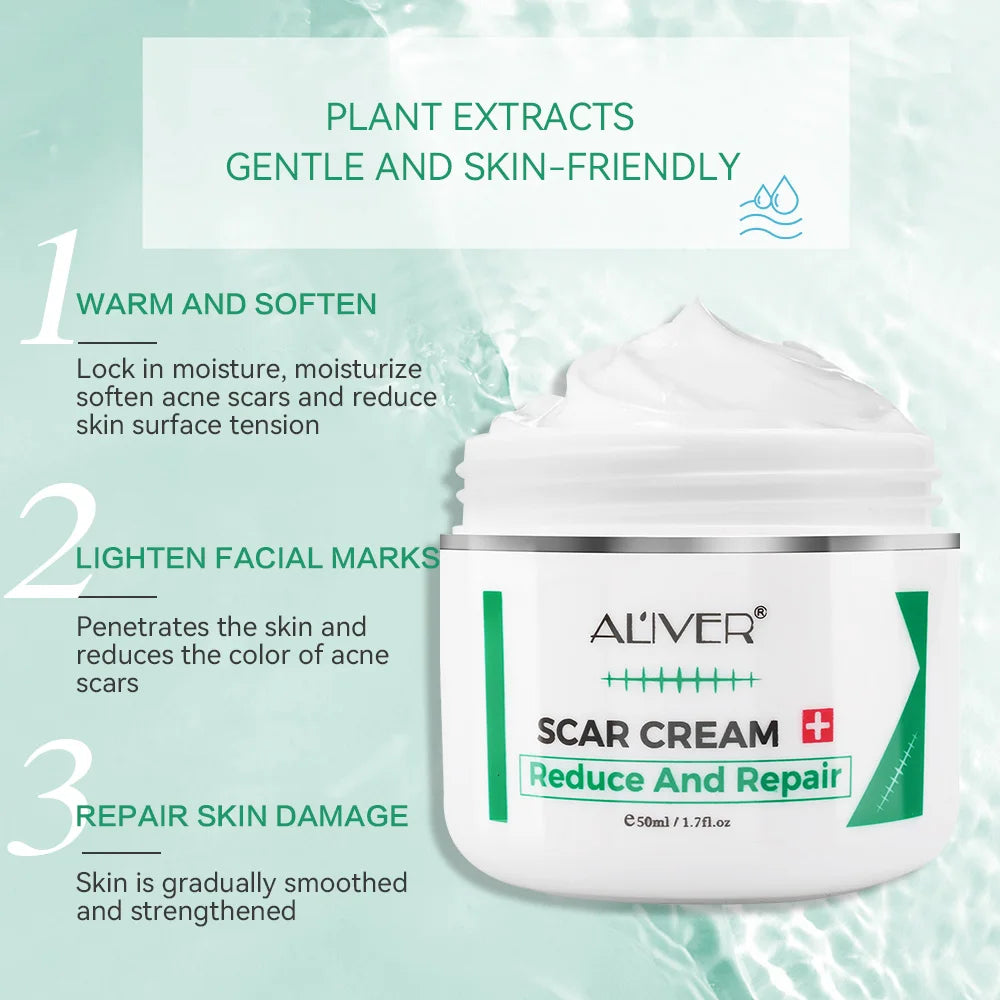 ALVER Acne Scar & Stretch Mark Remover Cream – 50ml Peaceful Pleasures Health and Wellness
