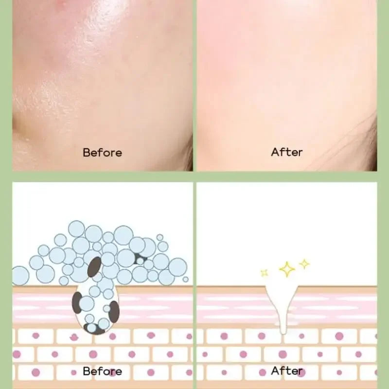 FENYI Green Tea Mud Mask 100g – Cleanse, Hydrate & Glow