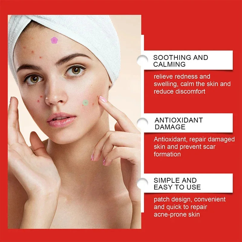240pc Salicylic Acid Acne Patches – Colorful Pimple Stickers Peaceful Pleasures Health and Wellness