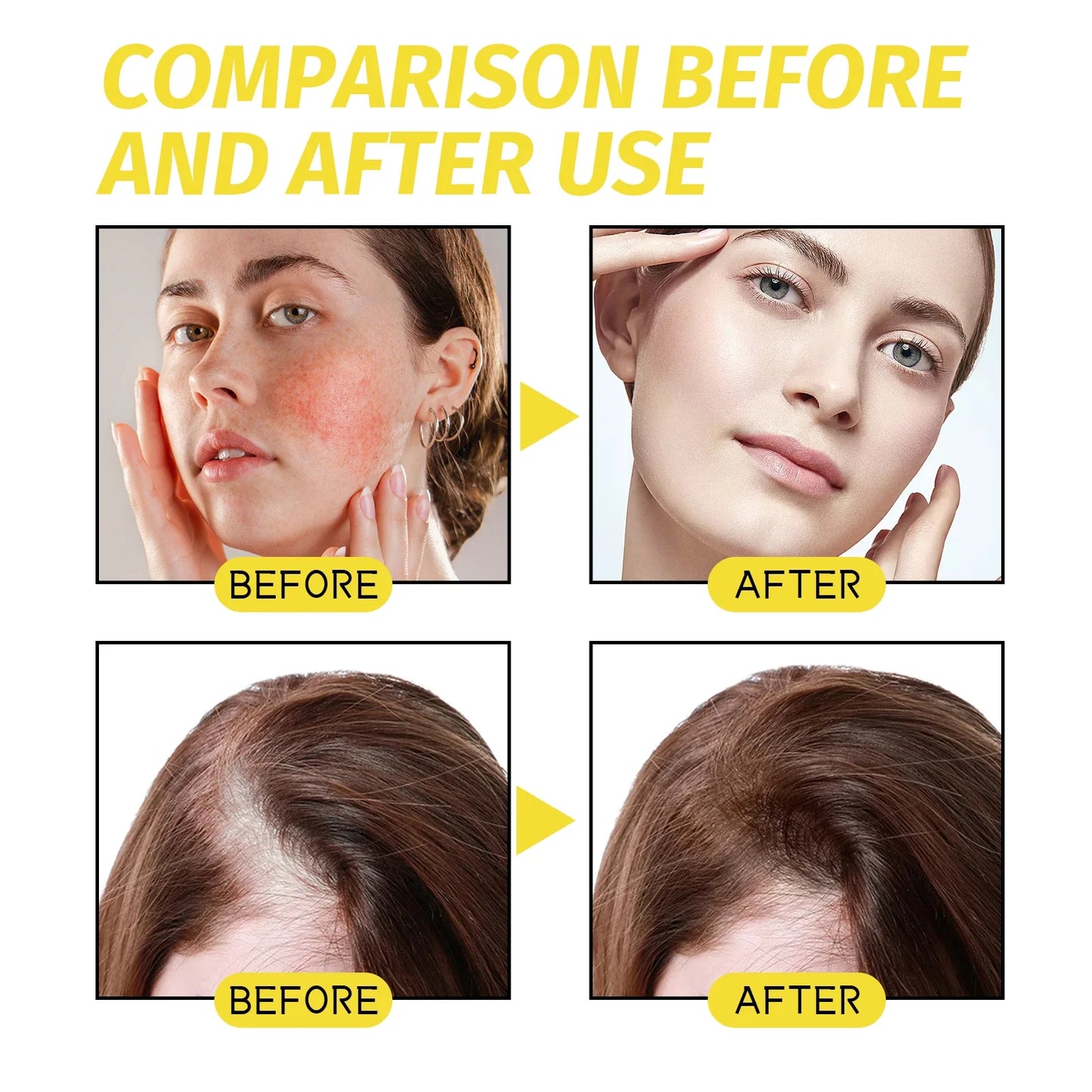 Eelhoe Hair Growth Essential Oil – Scalp & Follicle Treatment