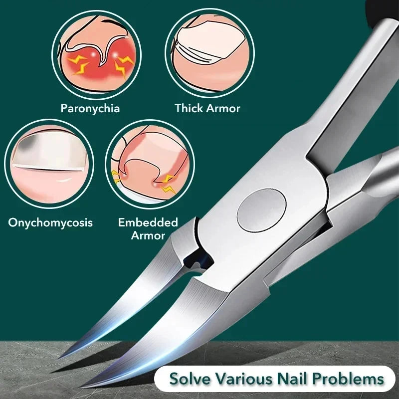 Professional Toenail Clipper Kit – Surgical Steel Nail Care Set