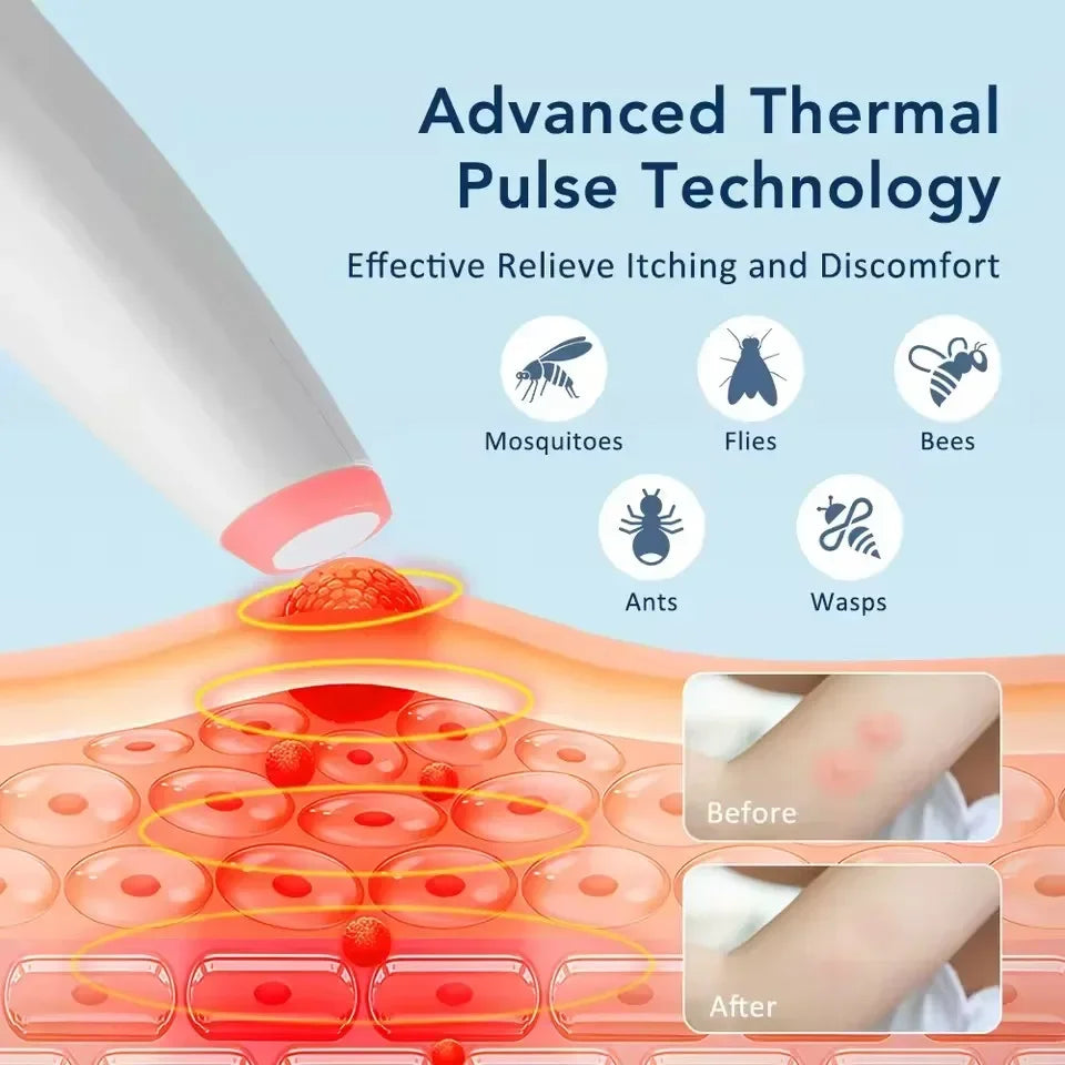 New Infrared Pulse Anti-Itch Device Portable Heated Relief Electric Stick Pen for Kids & Adults Outdoor Use for Mosquito Bites Peaceful Pleasures Health and Wellness