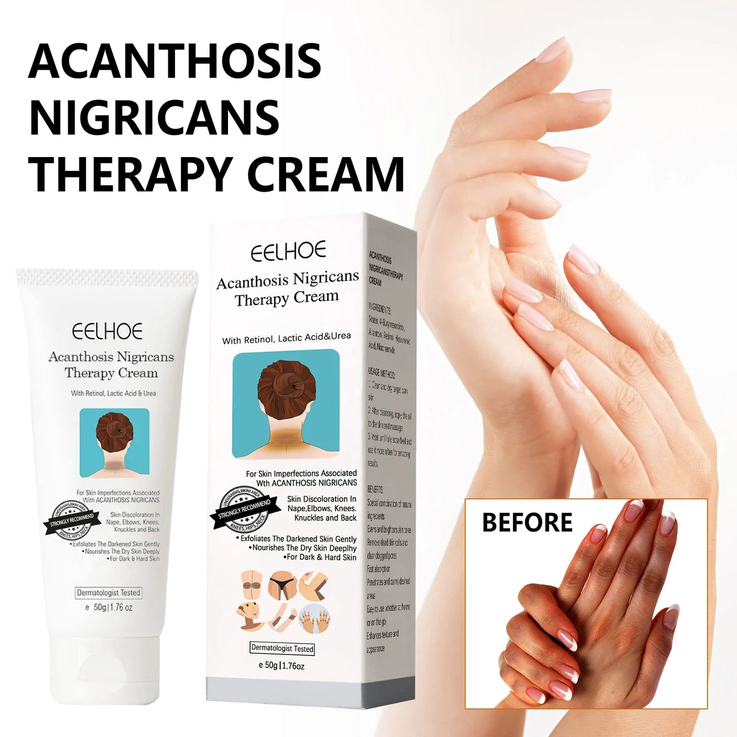 EELHOE Brightening Body Cream for Dark Spots, Neck & Underarms