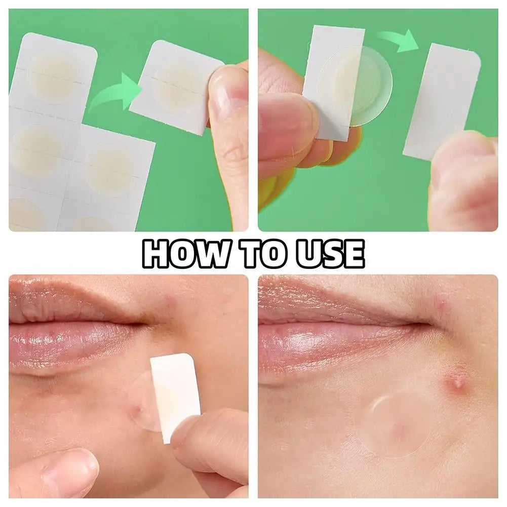 Micro Needle Pimple Patches – 2-Pack Hydrocolloid Acne Patches for Overnight Blemish Treatment Peaceful Pleasures Health and Wellness