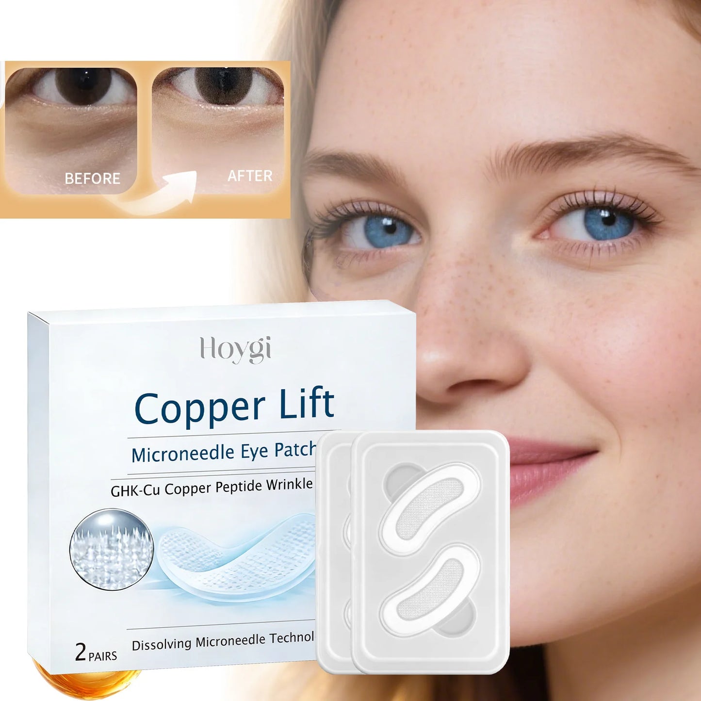 Microneedle Eye Patches – Dark Circles, Puffiness & Anti-Aging