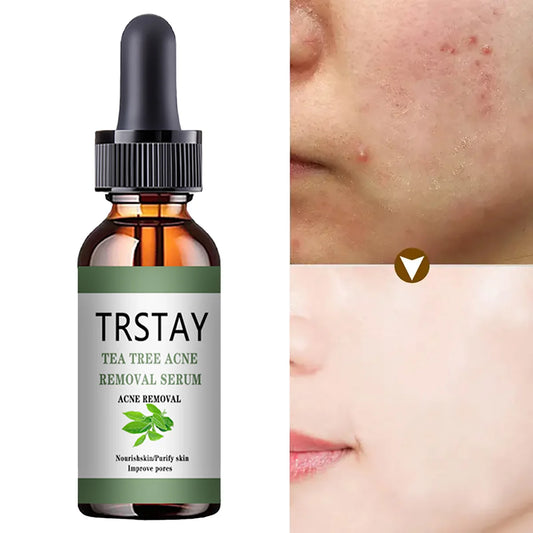 Acne Treatment Face Serum Tea Tree Oil Essence Moisturizing Shrink Pores Acne Facial Serum Korean Skin Care Products Peaceful Pleasures Health and Wellness 30ml