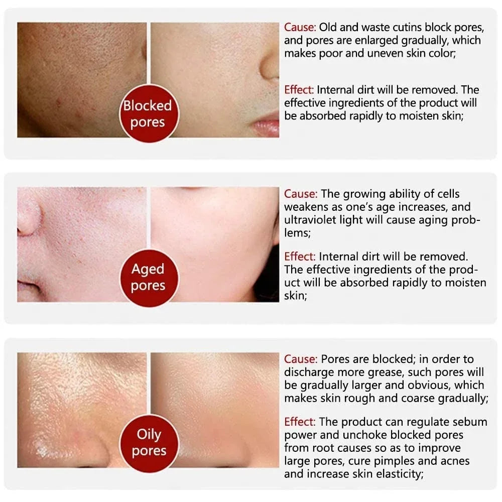 Pore Refining Facial Serum with Retinol & Niacinamide – 10mL