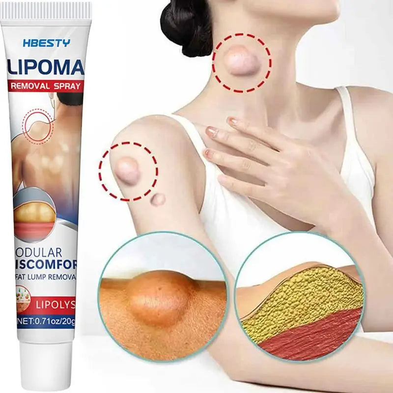 Herbal Skin Smoothing Cream – Fat Bulge & Lump Care 20g