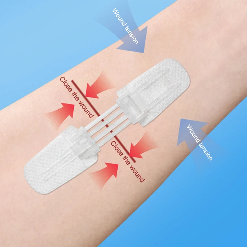 Zip Suture Wound Closure Strips | Steri-Strip Alternative