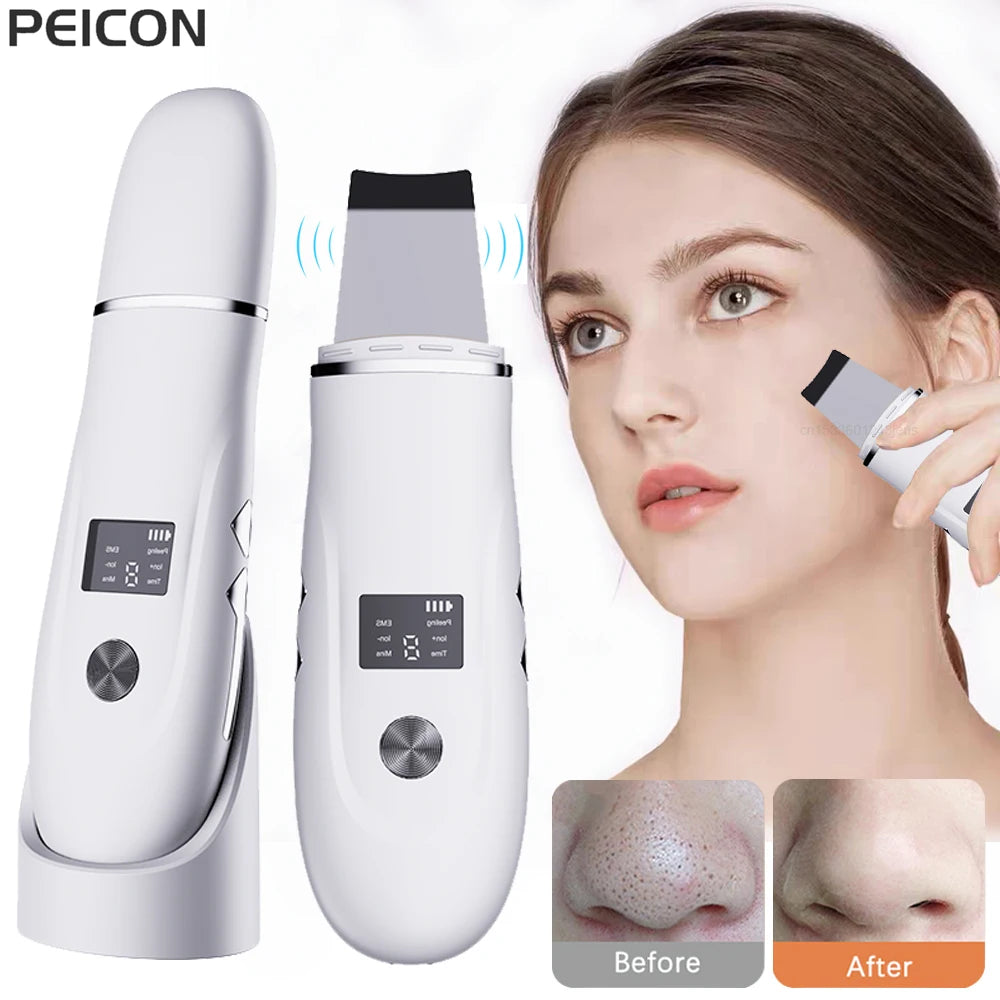 Ultrasonic Skin Scrubber Blackhead Remover Ultrasonic Peeling Pore Cleaner Face Cleaning Scrubber Ultrasonic Facial Espatula Peaceful Pleasures Health and Wellness