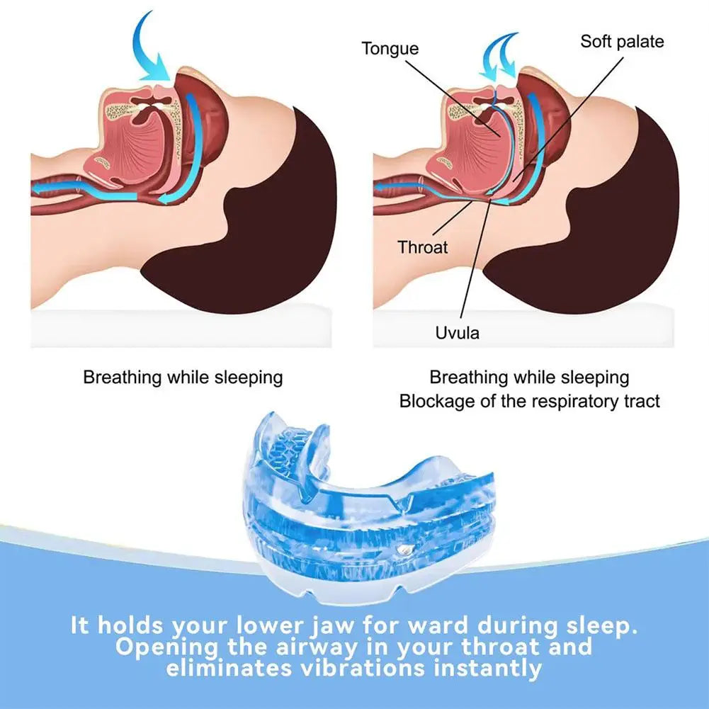 Adjustable Anti-Snoring Mouth Guard & Bruxism Night Guard