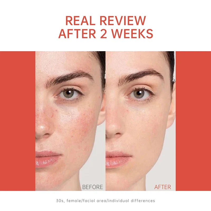PDRN Salmon DNA Serum Ampoule | Hydrating Firming Essence