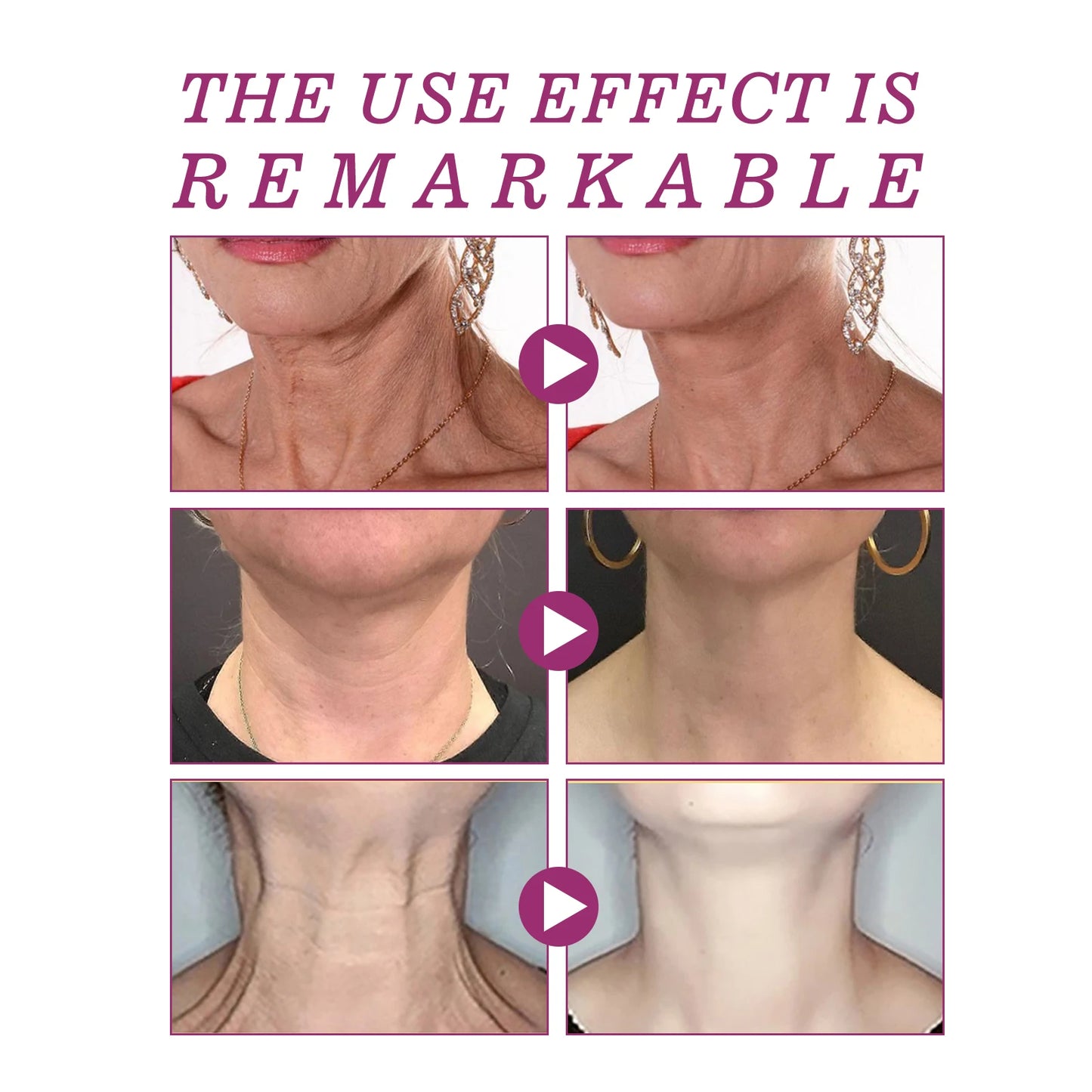 Jaysuing Collagen Neck Cream – Firming, Lifting & Anti-Aging