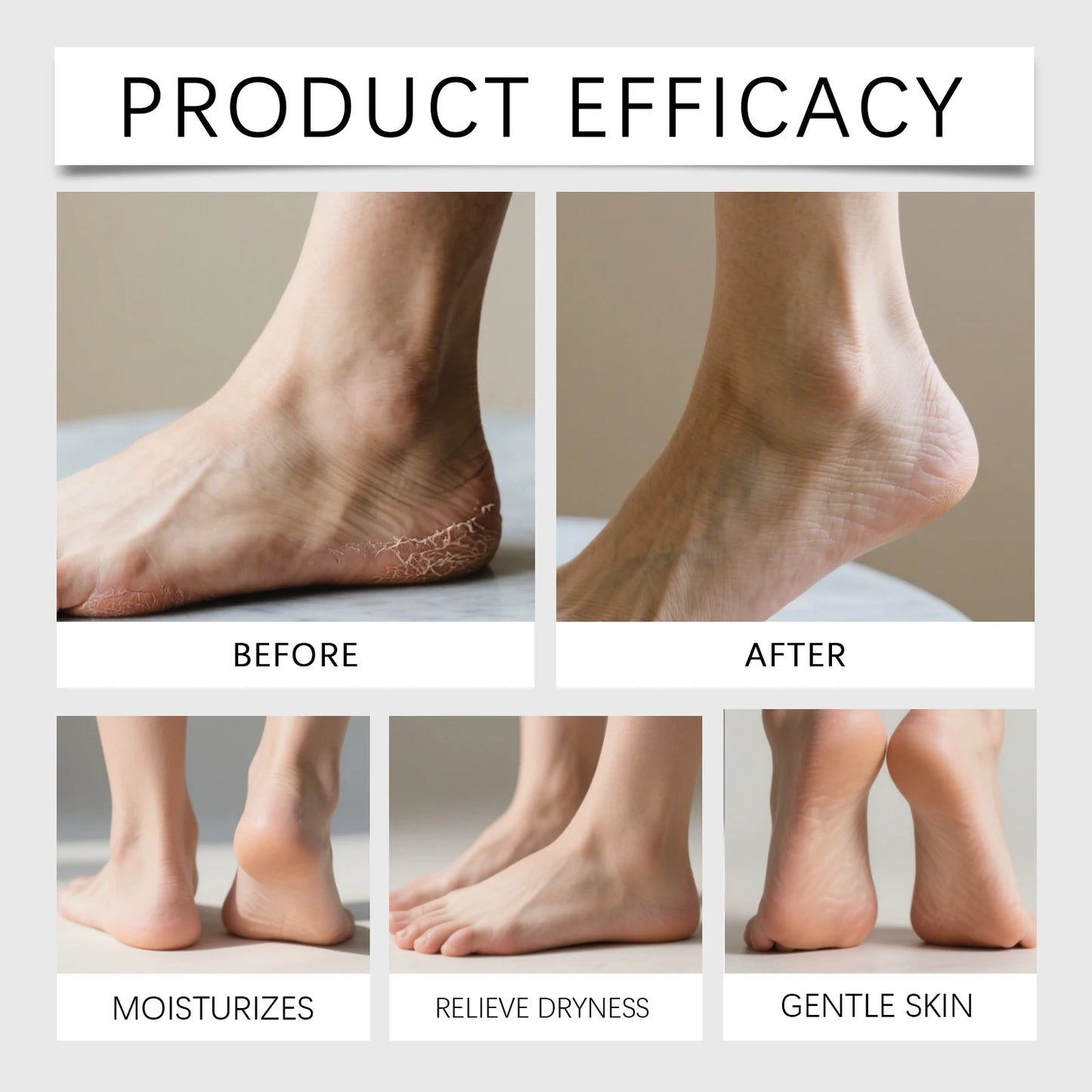 OceAura Urea 40% Foot Cream – Hydrating Heel & Skin Care