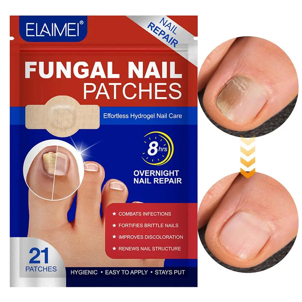 21pc Gray Toe Nail Sticker Fungal Nail Repair Patch Ingrown Correction Sticker Toenail Care Paronychia Nail Treatment Patch CarE Peaceful Pleasures Health and Wellness
