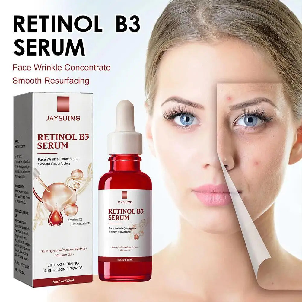 B3 Retinol Face Serum with Hyaluronic Acid – Anti-Aging 30ml
