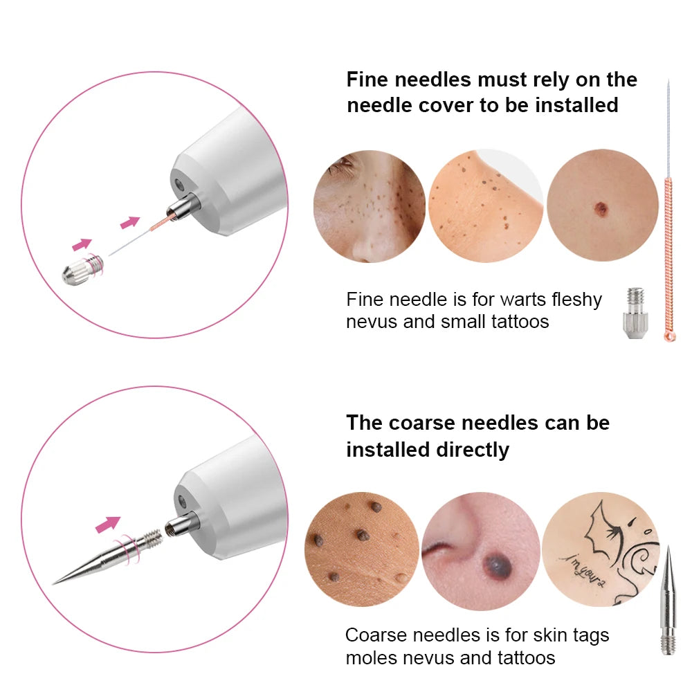 Laser Plasma Pen Needles Set For Dark Spot Freckle Mole Wart Tattoo Skin Tag Remover Face Skin Care Tool Replacement Accessories Peaceful Pleasures Health and Wellness