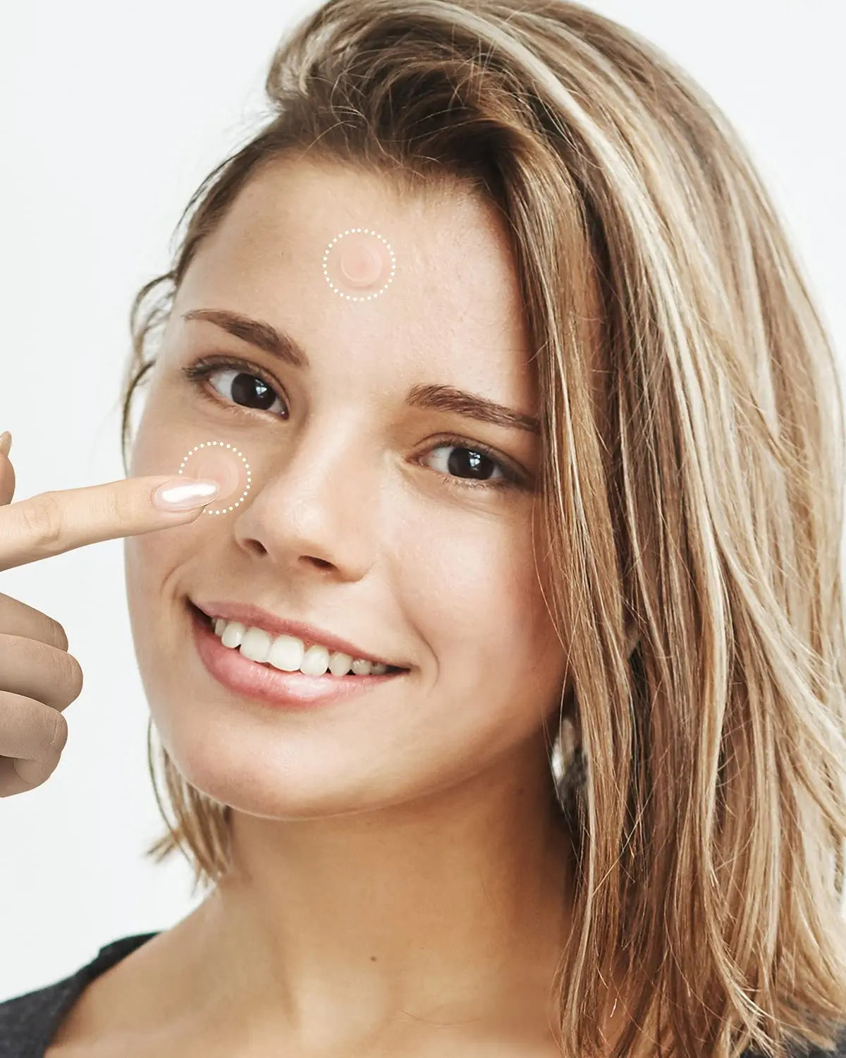Hydrocolloid Acne Patches – Invisible, Waterproof, All Skin Types
