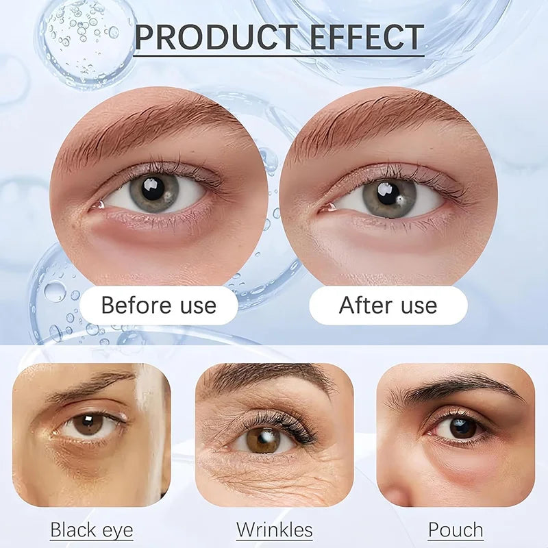 Instant Firming Eye Cream – Dark Circles & Puffiness