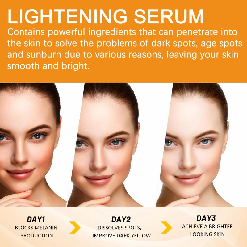 Vitamin C Face Serum – Dark Spot Remover & Brightening