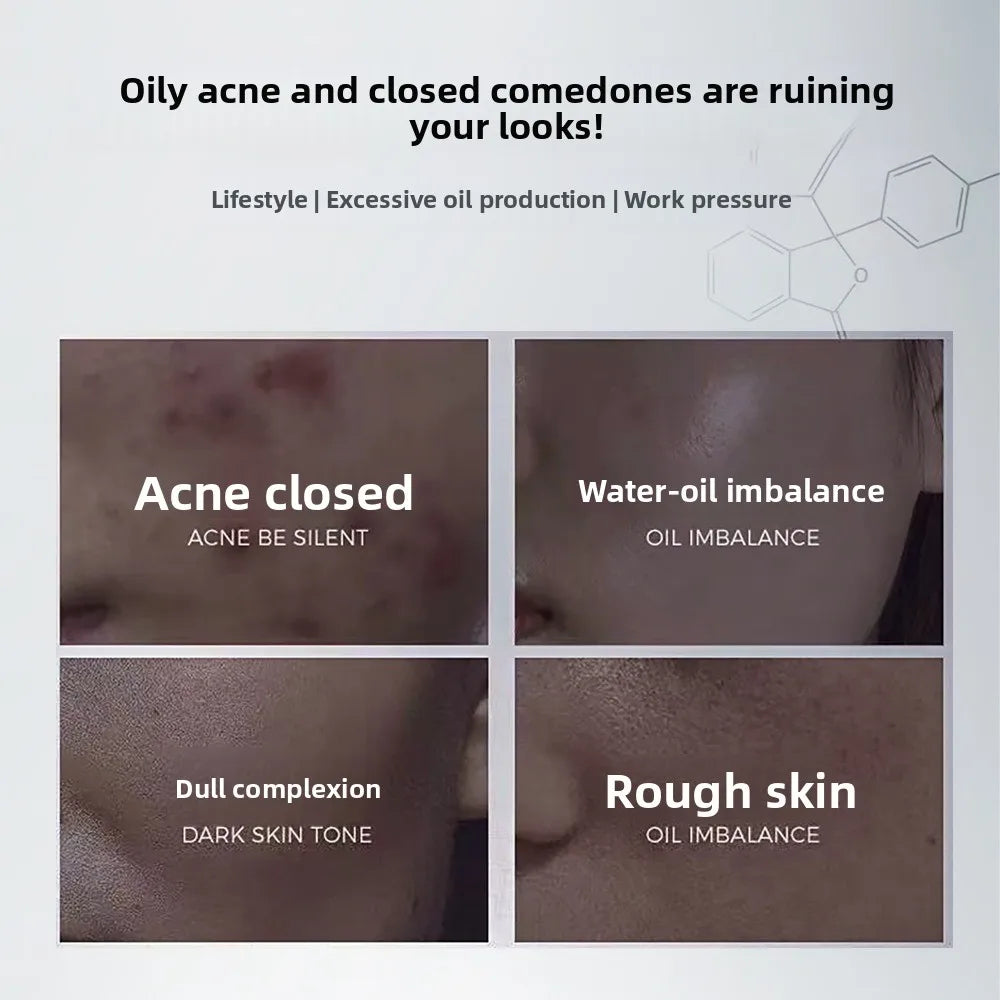 Eelhoe Anti-Aging Face Serum – Wrinkles & Pore Minimizer