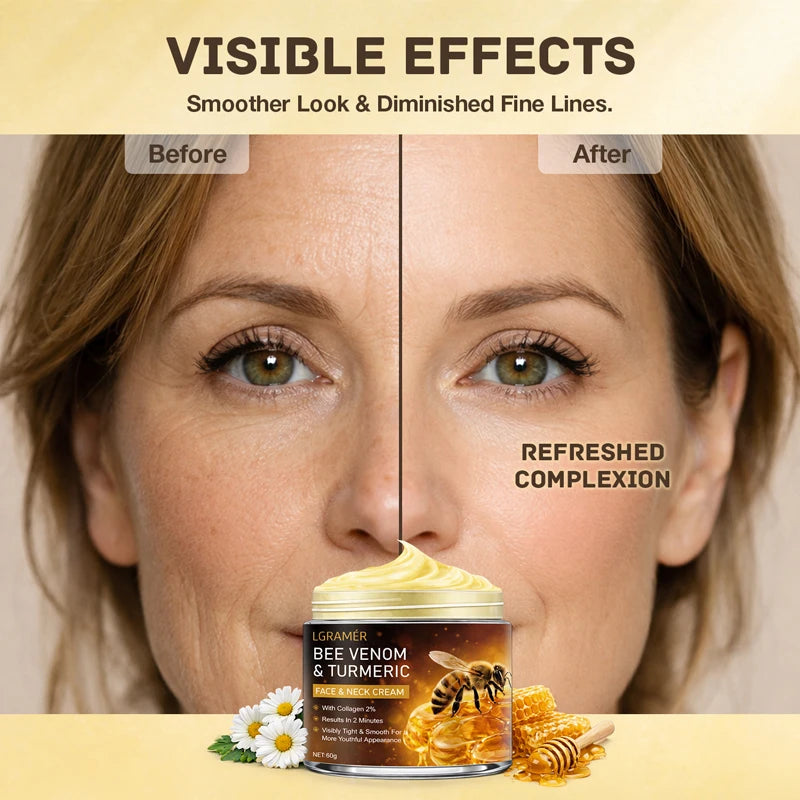 Bee Venom Facial Neck Lifting Cream Firms and Lifts Loose Skin, Smoothes Skin | Alcohol-Free, Containing Hyaluronic Acid,30g/60g Peaceful Pleasures Health and Wellness