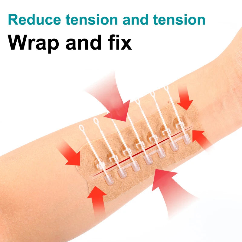 Zipper Wound Closure Patch – Suture-Free Hemostatic Bandage