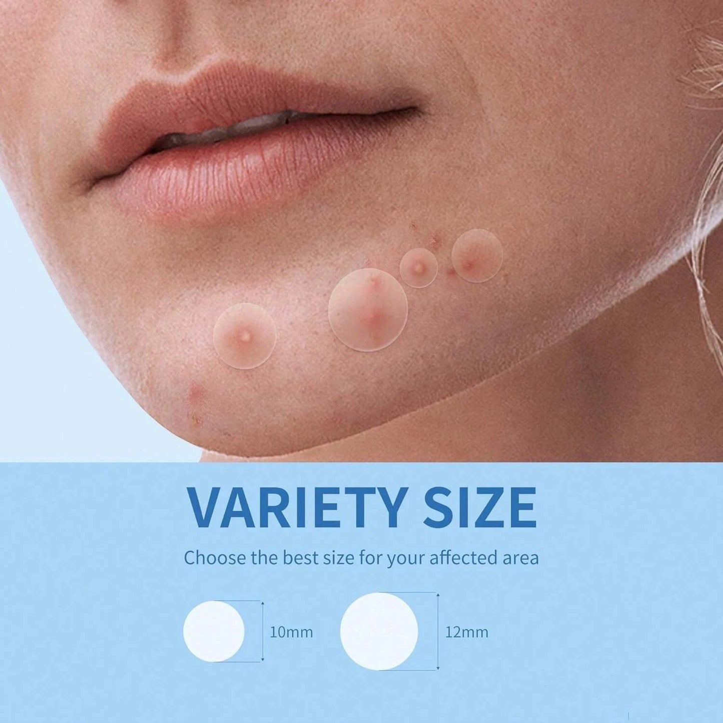Invisible Hydrocolloid Acne Patches – Waterproof, All Skin Types