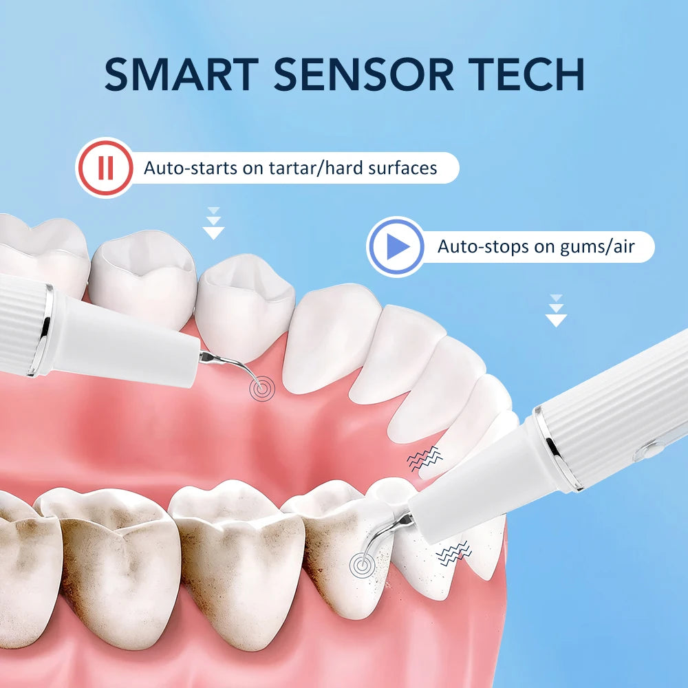 Electric Teeth Cleaner Dental Scaler Plaque Tartar Calculus Stain Remover Oral Care Rechargeable Home Use Teeth Whitening Kit Peaceful Pleasures Health and Wellness