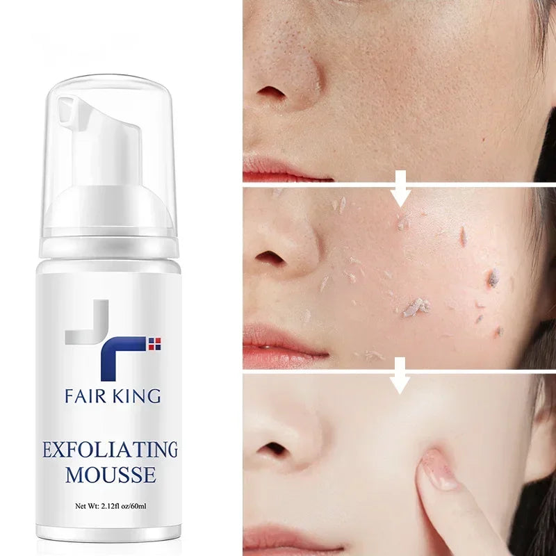 Exfoliating Cleansing Mousse | Pore Refining & Oil Control