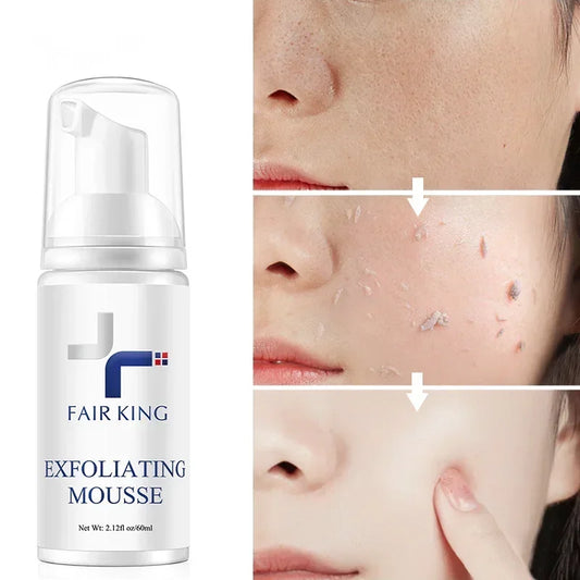 Exfoliating Cleansing Mousse | Pore Refining & Oil Control Exfoliating Cleanser Peaceful Pleasures Health and Wellness