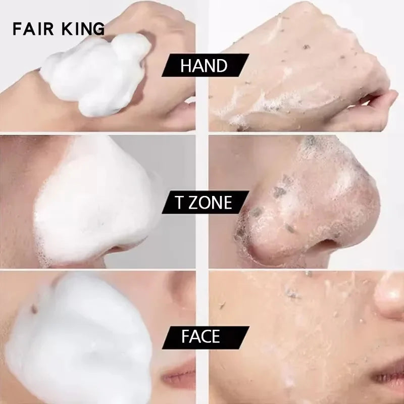Face Exfoliating Gel | Deep Pore Cleansing & Dead Skin Scrub