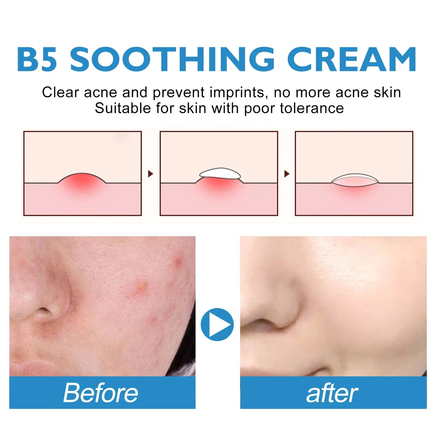 B5 Repair Cream – Vitamin B5 & Centella Soothing Moisturizer