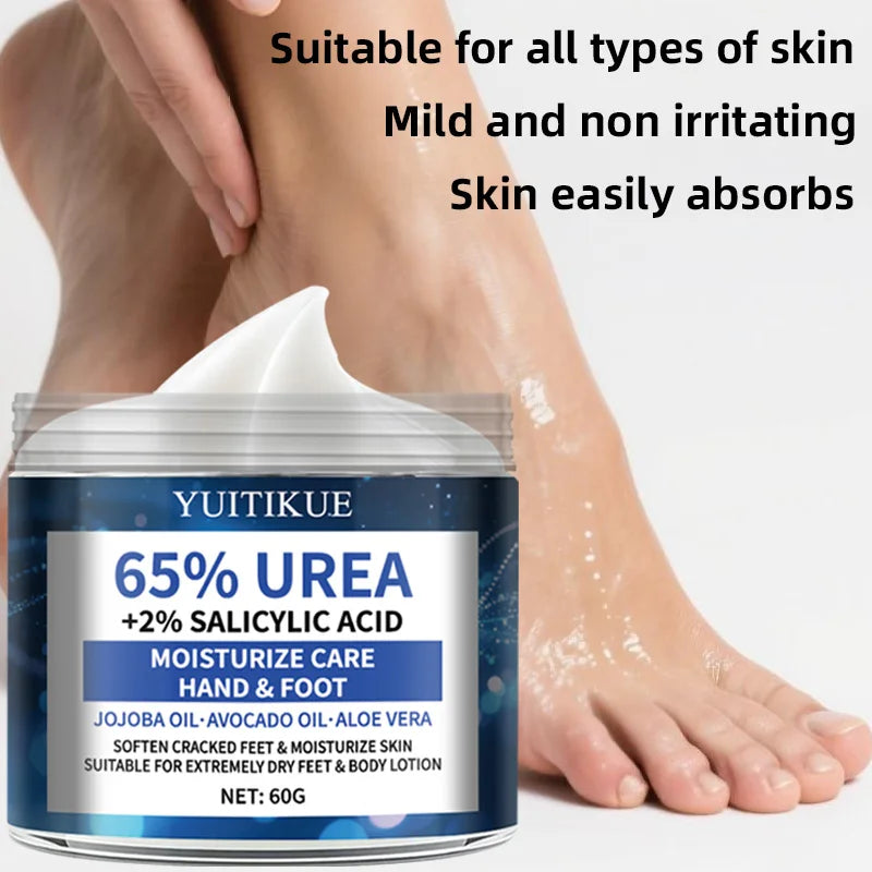YUITIKUE 65% Urea Foot Cream – Cracked Heel Repair 60g Urea Foot Cream Peaceful Pleasures Health and Wellness