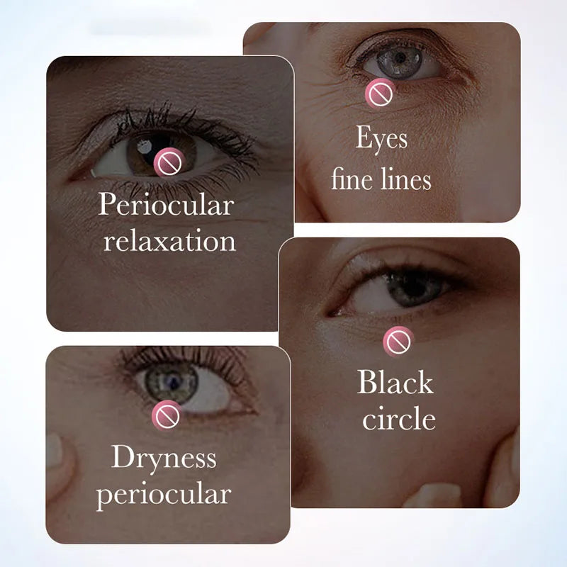 SADOER Sakura Eye Cream – Dark Circles & Anti-Aging Moisturizer