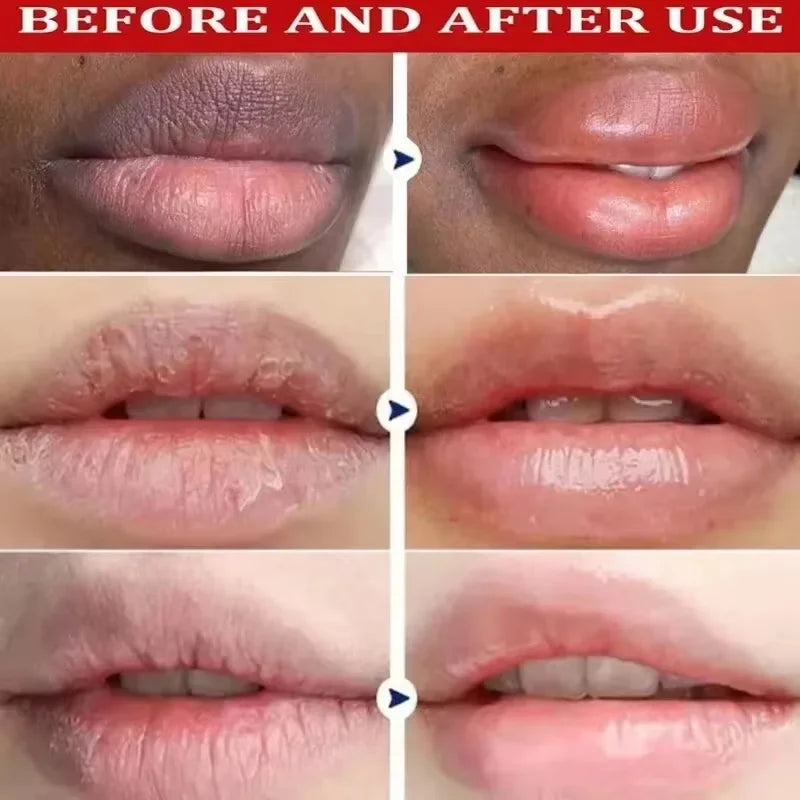 Brightening Lip Balm – Exfoliating Moisturizing Lip Mask & Gloss