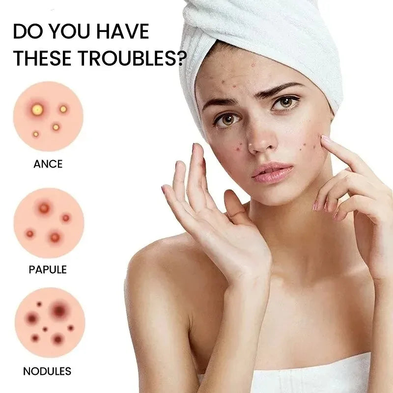 200pcs Star Acne Pimple Patches Colorful Breathable Removal Pimple Absorb Secretions Anti Infection Concealer Makeup Skin Care Peaceful Pleasures Health and Wellness