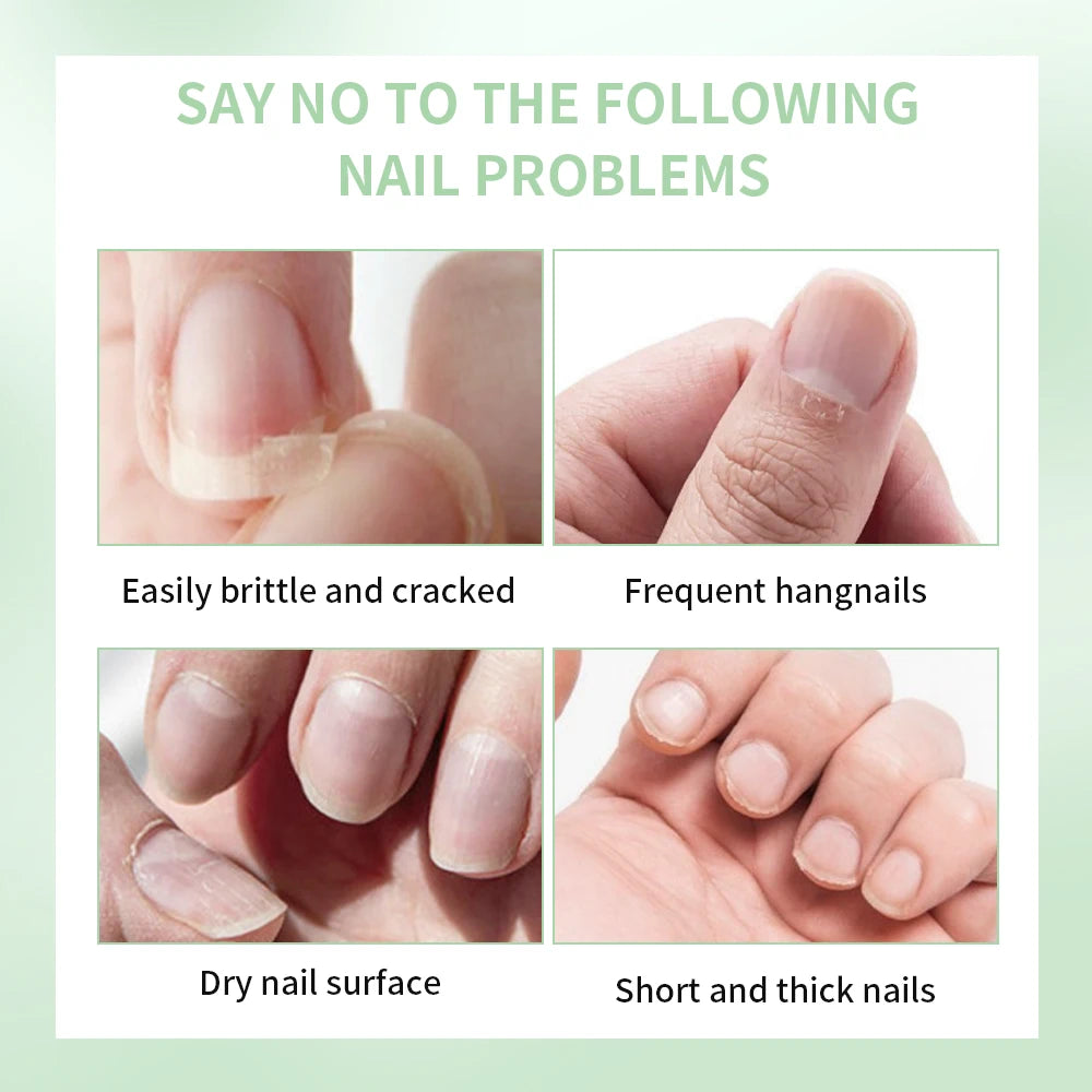 Nail Treat -Growth Nail Strengthener Healthy Strong Nail Growth Oil Help Splits Thin Nails Repair Manicure Nail Hardener Polish Peaceful Pleasures Health and Wellness