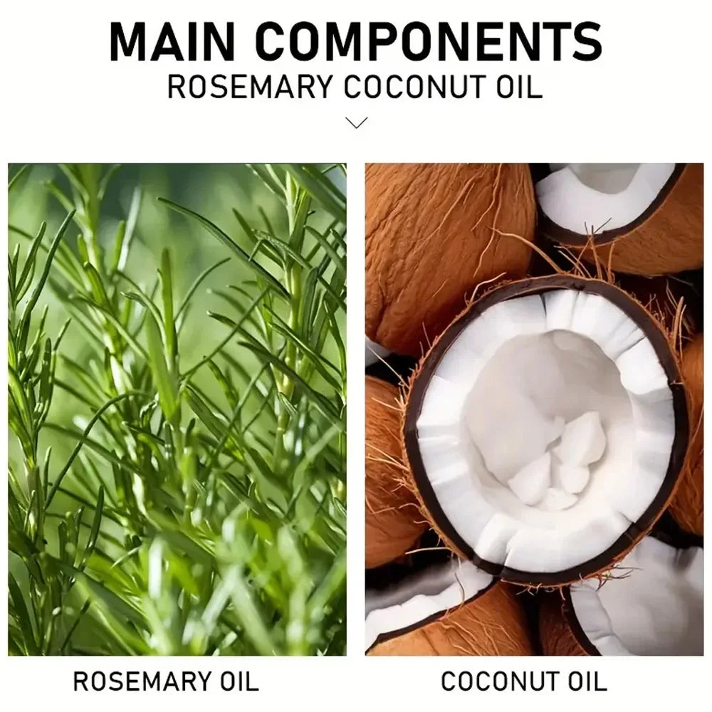 YOUNGCOME Rosemary & Coconut Oil Scalp Serum | Hair Treatment