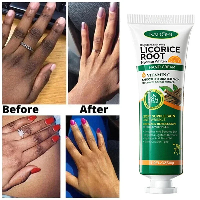 Brightening Hand Cream – Dark Knuckle & Skin Tone Corrector