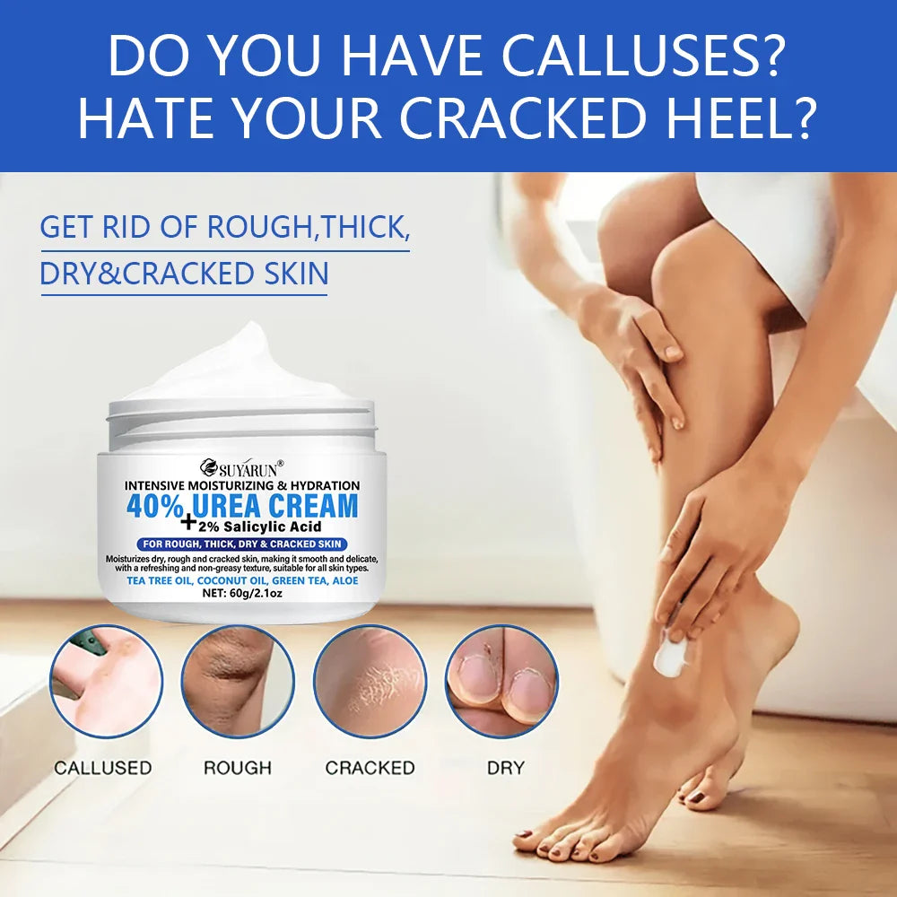 SUYARUN 40% Urea Foot Cream Stick – Hydrate & Exfoliate Heels
