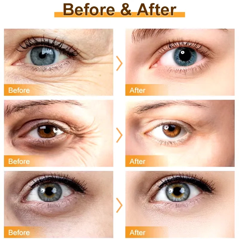Instant Eye Bag Removal Rolling Beads Massage Serum Retinol Anti-Wrinkle Firm Skin Anti Dark Circle Puffiness Brighten Eye Care Peaceful Pleasures Health and Wellness