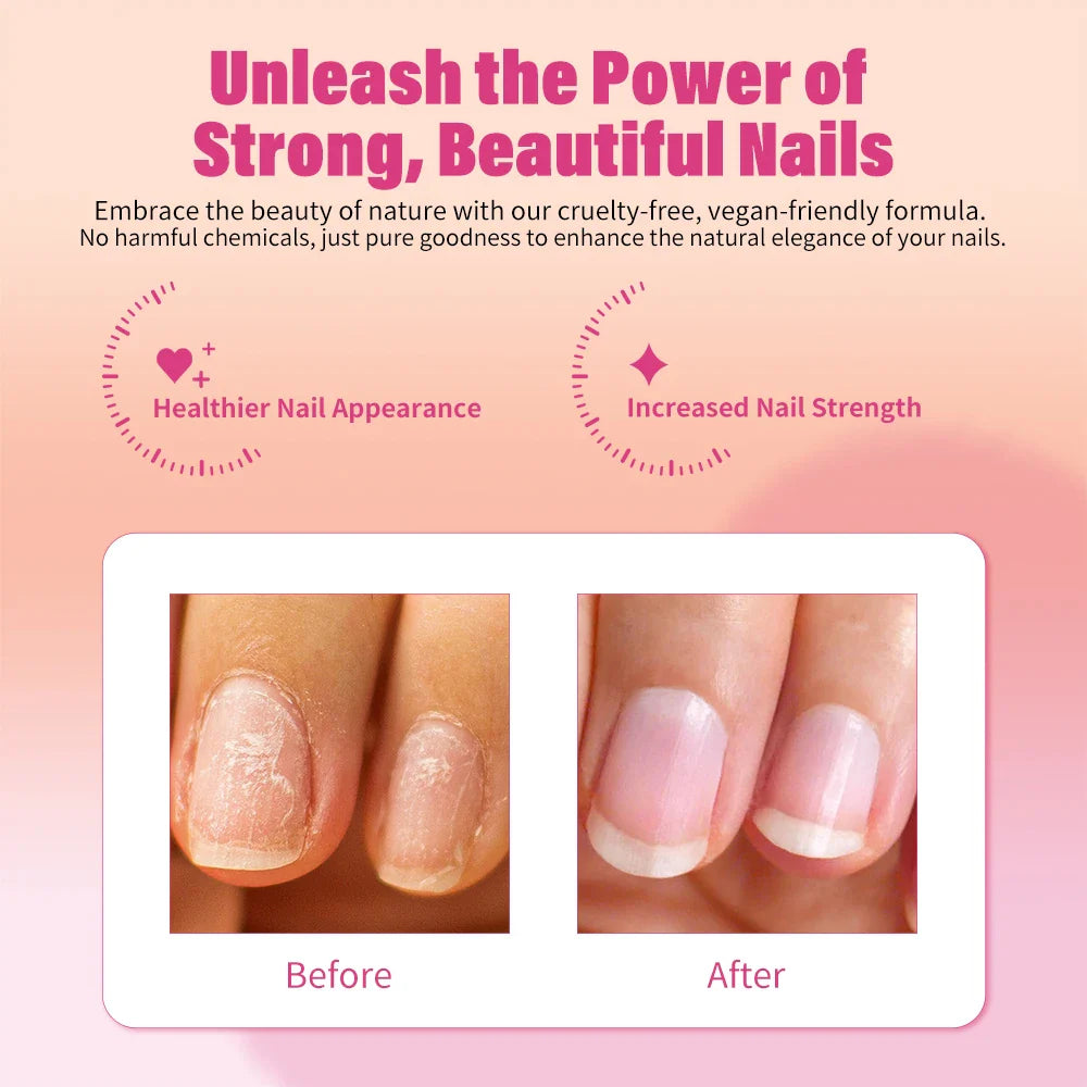 Nail Strengthener Cuticle Oil – Stop Splits, Chips & Cracks