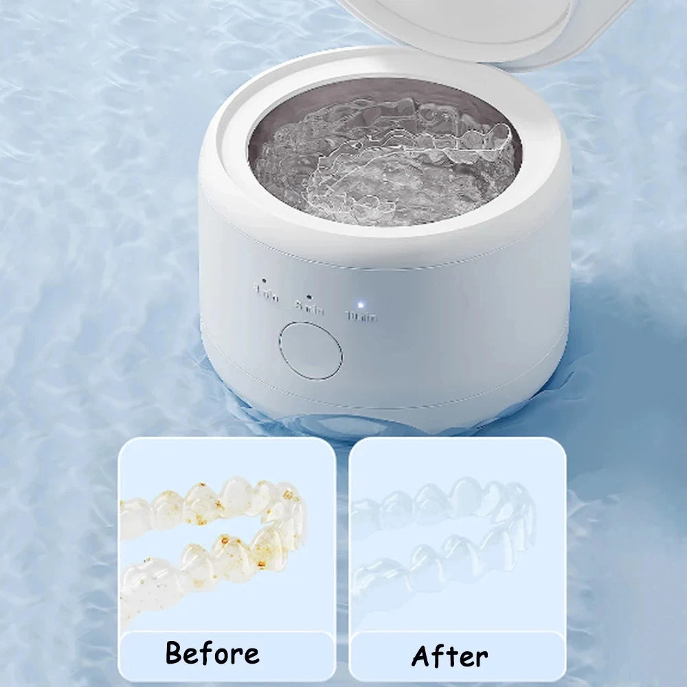 Ultrasonic Cleaner 50Khz Ultrasonic Cleaner Machine High Frequency Ultrasonic Cleaning Bath For Jewelry And Teeth Brace Peaceful Pleasures Health and Wellness