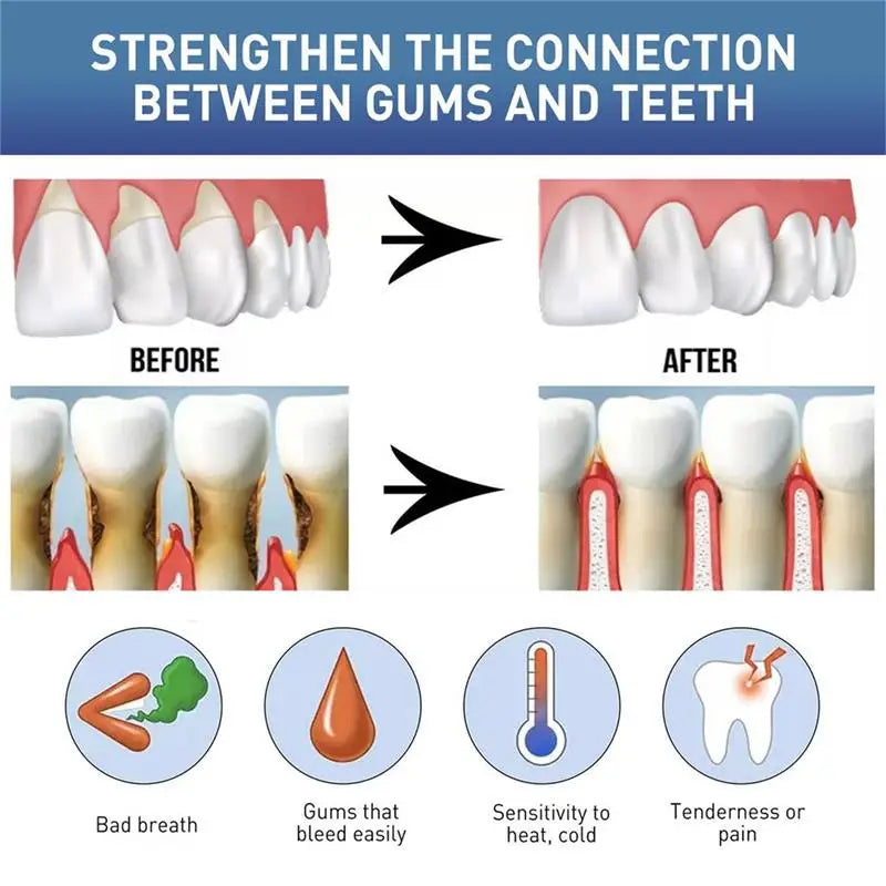 Eelhoe Gum Care Repair Gel – Whitening & Fresh Breath | 3ml