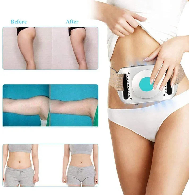 VamsLuna Fat Freezing Belt | Cryolipolysis Body Slimming Device
