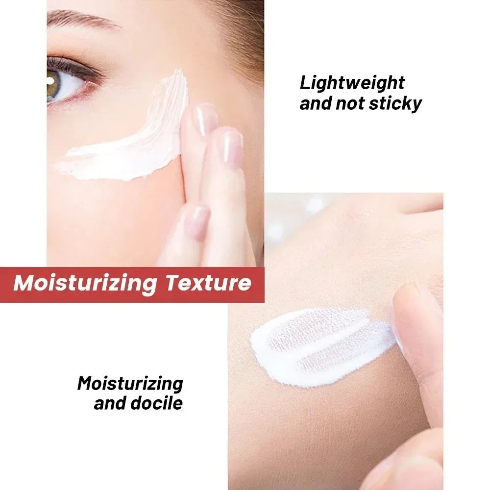 1/3/5pcs Whitening Freckle Cream Niacinamide Remove Dark Spot Cream Anti Freckle and Aging Cream Fade Pigmentation Melasma Skin Peaceful Pleasures Health and Wellness